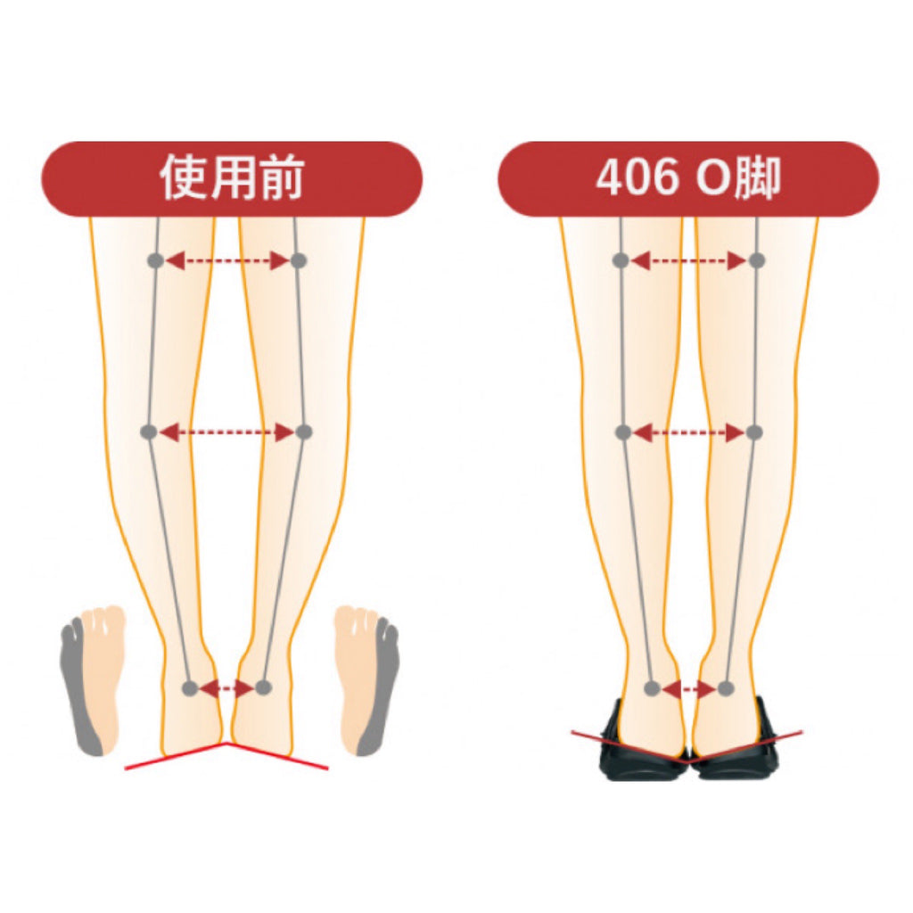 AKAISHIアーチフィッター O脚バックベルトサンダル